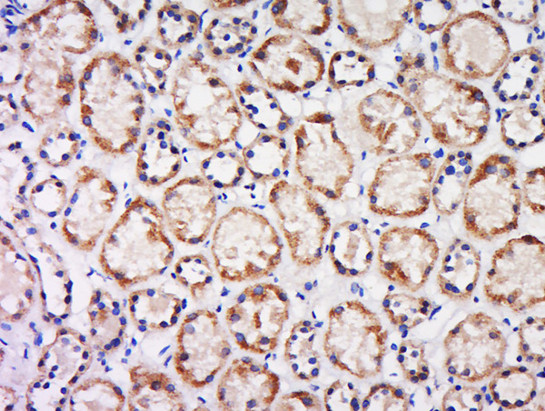 Paraformaldehyde-fixed, paraffin embedded human kidney; Antigen retrieval by boiling in sodium citrate buffer (pH6) for 15min; Block endogenous peroxidase by 3% hydrogen peroxide for 30 minutes; Blocking buffer (normal goat serum) at 37°C for 20min; Antibody incubation with Rabbit Anti-CX3CL1 Polyclonal Antibody, Unconjugated (bs-0811R) at 1:200 overnight at 4°C, followed by a conjugated secondary and DAB staining.