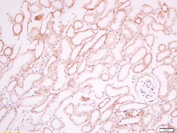 Paraformaldehyde-fixed, paraffin embedded mouse kidney tissue; Antigen retrieval by boiling in sodium citrate buffer(pH6) for 15min; Block endogenous peroxidase by 3% hydrogen peroxide for 30 minutes; Blocking buffer (normal goat serum) at 37°C for 20min; Antibody incubation with Rabbit Anti-CD34 Polyclonal Antibody, Unconjugated (bs-8996R) at 1:200 overnight at 4°C, followed by a conjugated secondary and DAB staining Paraformaldehyde-fixed, paraffin embedded mouse kidney tissue; Antigen retrieval by boiling in sodium citrate buffer(pH6) for 15min; Block endogenous peroxidase by 3% hydrogen peroxide for 30 minutes; Blocking buffer (normal goat serum) at 37°C for 20min; Antibody incubation with Rabbit Anti-CD34 Polyclonal Antibody, Unconjugated (bs-8996R) at 1:200 overnight at 4°C, followed by a conjugated secondary and DAB staining