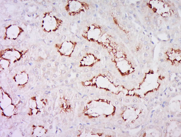 Paraformaldehyde-fixed, paraffin embedded rat kidney; Antigen retrieval by boiling in sodium citrate buffer (pH6) for 15min; Block endogenous peroxidase by 3% hydrogen peroxide for 30 minutes; Blocking buffer (normal goat serum) at 37°C for 20min; Antibody incubation with Rabbit Anti-Klotho Polyclonal Antibody, Unconjugated (bs-2925R) at 1:200 overnight at 4°C, followed by a conjugated secondary and DAB staining.