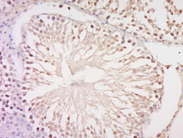 Paraformaldehyde-fixed, paraffin embedded rat testis; Antigen retrieval by boiling in sodium citrate buffer (pH6) for 15min; Block endogenous peroxidase by 3% hydrogen peroxide for 30 minutes; Blocking buffer (normal goat serum) at 37°C for 20min; Antibody incubation with Rabbit Anti-C17orf64 Polyclonal Antibody, Unconjugated (bs-9643R) at 1:500 overnight at 4°C, followed by a conjugated secondary and DAB staining.