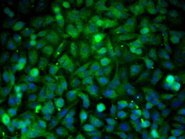 Image provided by One World Lab validation program. A549 cells probed with Rabbit Anti-PTP1B Polyclonal Antibody (bs-0182R) at 1:100 for 60 minutes at room temperature followed by Goat Anti-Rabbit IgG (H+L) Alexa Fluor 488 Conjugated secondary antibody.
