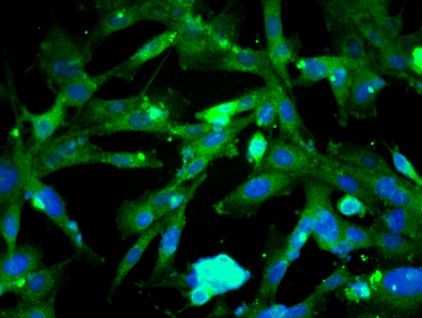 Image provided by One World Lab validation program. U138 cells probed with Rabbit Anti-Beta catenin Polyclonal Antibody (bs-1165R) at 1:50 for 60 minutes at room temperature followed by Goat Anti-Rabbit IgG (H+L) Alexa Fluor 488 Conjugated secondary antibody.