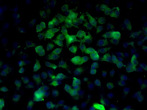 Image provided by One World Lab validation program. MCF-7 cells probed with Rabbit Anti-Beta catenin Polyclonal Antibody (bs-1165R) at 1:50 for 60 minutes at room temperature followed by Goat Anti-Rabbit IgG (H+L) Alexa Fluor 488 Conjugated secondary antibody.