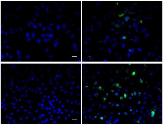 Image provided by One World Lab validation program. Hela(top) and MCF-7(bottom) cells were labeled with BrdU (10\u03bcM) and stained with Rabbit Anti-BrdU Polyclonal Antibody (bs-0489R) at 1:100 dilution. 2nd antibody without primary antibody was used as control included. Fluorescent signals were detected with primary antibody dilution in both Hela and MCF-7.