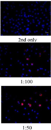 MCF-7 cells were labeled with BrdU (10\u03bcM) and stained with mouse monoclonal antibody against BrdU with dilution at 1:100 and 1:50. 2nd antibody without primary antibody was used as control included here. Fluorescent signals were detected with both 1:100 and 1:50 primary antibody dilution in both MCF-7 it shows nucleus staining.  Scale bar= 20 \u03bcm.