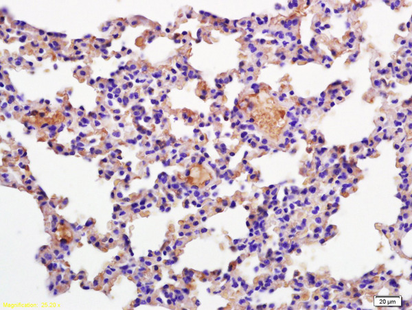 Formalin-fixed and paraffin embedded mouse lung labeled with Rabbit Anti CD69/CLEC2C/AIM Polyclonal Antibody, Unconjugated (bs-2499R) at 1:200 followed by conjugation to the secondary antibody and DAB staining