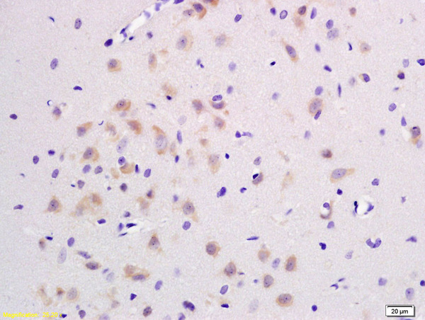 Formalin-fixed and paraffin embedded rat brain labeled with  Rabbit Anti JNK1\/2\/3 Polyclonal Antibody, Unconjugated (bs-2592R) at 1:200 followed by conjugation to the secondary antibody and DAB staining