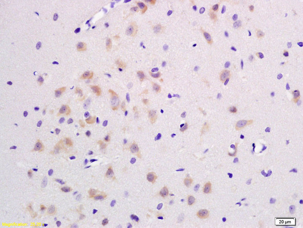 Formalin-fixed and paraffin embedded rat brain labeled with Rabbit Anti JNK1/2/3 Polyclonal Antibody, Unconjugated (bs-2592R) at 1:200 followed by conjugation to the secondary antibody and DAB staining