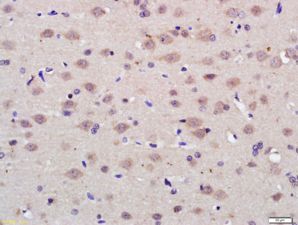 Paraformaldehyde-fixed, paraffin embedded rat brain tissue; Antigen retrieval by boiling in sodium citrate buffer(pH6) for 15min; Block endogenous peroxidase by 3% hydrogen peroxide for 30 minutes; Blocking buffer (normal goat serum) at 37°C for 20min; Antibody incubation with Rabbit Anti-PAG1 Polyclonal Antibody, Unconjugated (bs-13695R) at 1:200 overnight at 4°C, followed by a conjugated secondary and DAB staining
