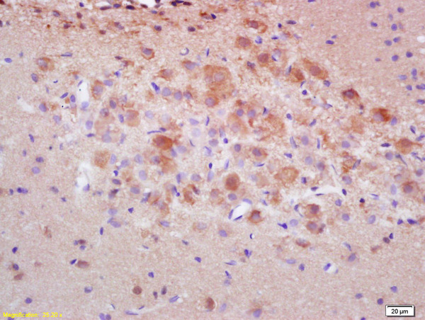 Formalin-fixed and paraffin embedded rat brain labeled with  Rabbit Anti pro-caspase-3 Polyclonal Antibody, Unconjugated (bs-2593R) at 1:200 followed by conjugation to the secondary antibody and DAB staining