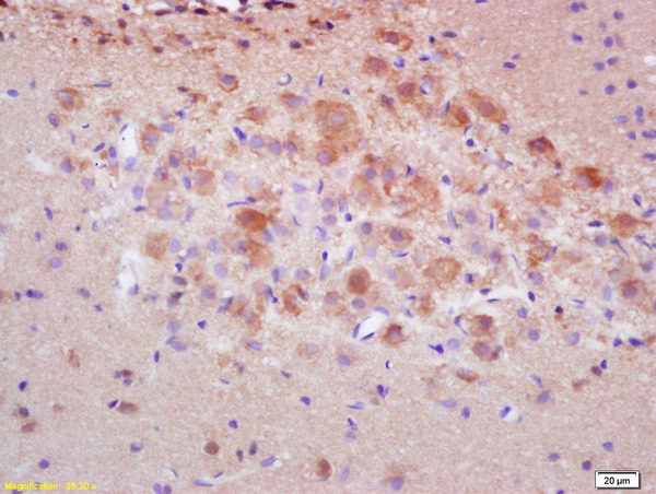 Formalin-fixed and paraffin embedded rat brain labeled with Rabbit Anti pro-caspase-3 Polyclonal Antibody, Unconjugated (bs-2593R) at 1:200 followed by conjugation to the secondary antibody and DAB staining