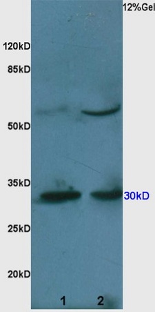 L1 mouse brain lysates L2 mouse liver lysates probed with Anti pro-caspase-3 Polyclonal Antibody, Unconjugated (bs-2593R) at 1:200 overnight at 4˚C. Followed by conjugation to secondary antibody (bs-0295G-HRP) at 1:3000 for 90 min at 37˚C. Predicted band 30kD. Observed band size:30kD.\\n