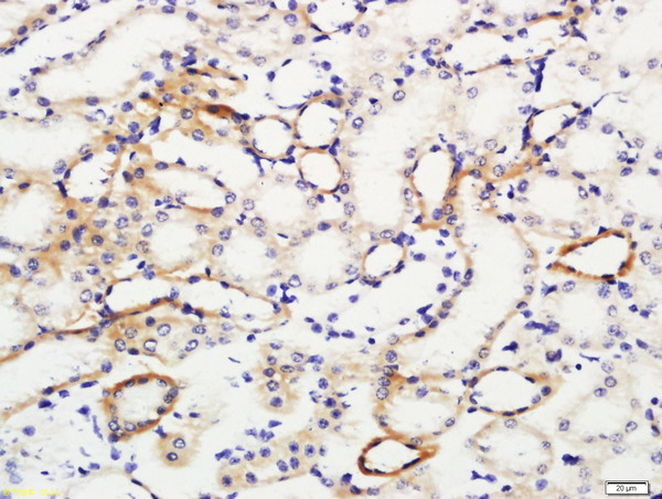 Paraformaldehyde-fixed, paraffin embedded mouse kidney; Antigen retrieval by boiling in sodium citrate buffer (pH6) for 15min; Block endogenous peroxidase by 3% hydrogen peroxide for 30 minutes; Blocking buffer (normal goat serum) at 37°C for 20min; Antibody incubation with IL-10 Polyclonal Antibody, Unconjugated (bs-0698R) at 1:200 overnight at 4°C, followed by a conjugated secondary and DAB staining.