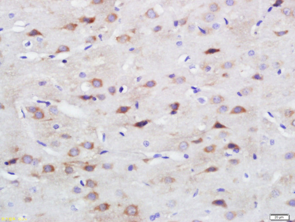 Paraformaldehyde-fixed, paraffin embedded rat brain; Antigen retrieval by boiling in sodium citrate buffer (pH6) for 15min; Block endogenous peroxidase by 3% hydrogen peroxide for 30 minutes; Blocking buffer (normal goat serum) at 37°C for 20min; Antibody incubation with SPARC Polyclonal Antibody, Unconjugated (bs-1133R) at 1:200 overnight at 4°C, followed by a conjugated secondary and DAB staining.