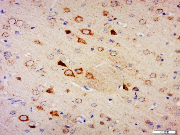 Paraformaldehyde-fixed, paraffin embedded rat brain; Antigen retrieval by boiling in sodium citrate buffer (pH6) for 15min; Block endogenous peroxidase by 3% hydrogen peroxide for 30 minutes; Blocking buffer (normal goat serum) at 37°C for 20min; Antibody incubation with Amphiphysin Polyclonal Antibody, Unconjugated (bs-2409R) at 1:200 overnight at 4°C, followed by a conjugated secondary and DAB staining.