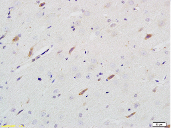 Formalin-fixed and paraffin embedded rat brain tissue labeled with Rabbit Anti-Neuroligin 1 Polyclonal Antibody (bs-4212R) at 1:200 followed by conjugation to the secondary antibody and DAB staining.