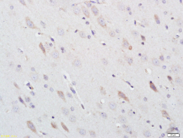 Paraformaldehyde-fixed, paraffin embedded rat brain; Antigen retrieval by boiling in sodium citrate buffer (pH6) for 15min; Block endogenous peroxidase by 3% hydrogen peroxide for 30 minutes; Blocking buffer (normal goat serum) at 37°C for 20min; Antibody incubation with Nitrotyrosine Polyclonal Antibody, Unconjugated (bs-8551R) at 1:200 overnight at 4°C, followed by a conjugated secondary and DAB staining. Paraformaldehyde-fixed, paraffin embedded rat brain; Antigen retrieval by boiling in sodium citrate buffer (pH6) for 15min; Block endogenous peroxidase by 3% hydrogen peroxide for 30 minutes; Blocking buffer (normal goat serum) at 37°C for 20min; Antibody incubation with Nitrotyrosine Polyclonal Antibody, Unconjugated (bs-8551R) at 1:200 overnight at 4°C, followed by a conjugated secondary and DAB staining.