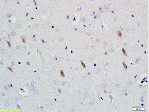 Formalin-fixed and paraffin embedded rat brain tissue labeled with Rabbit Anti-Neuroligin 1 Polyclonal Antibody (bs-4212R) at 1:200 followed by conjugation to the secondary antibody and DAB staining.
