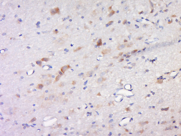 Paraformaldehyde-fixed, paraffin embedded rat brain; Antigen retrieval by boiling in sodium citrate buffer (pH6) for 15min; Block endogenous peroxidase by 3% hydrogen peroxide for 30 minutes; Blocking buffer (normal goat serum) at 37°C for 20min; Antibody incubation with Inhibin Beta C Polyclonal Antibody, Unconjugated (bs-1826R) at 1:200 overnight at 4°C, followed by a conjugated secondary and DAB staining.