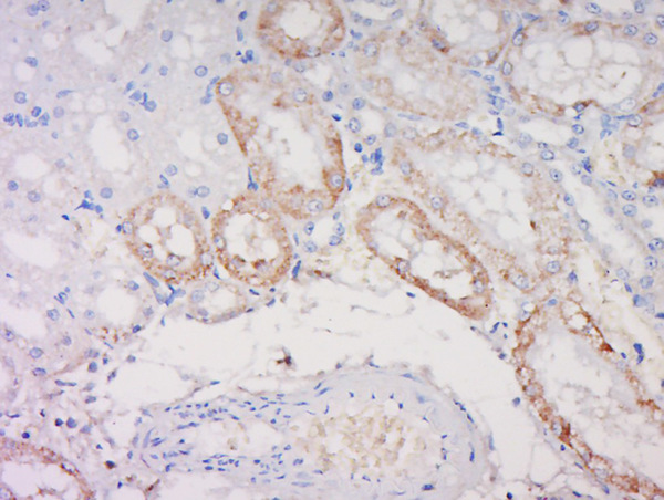 Paraformaldehyde-fixed, paraffin embedded rat kidney; Antigen retrieval by boiling in sodium citrate buffer (pH6) for 15min; Block endogenous peroxidase by 3% hydrogen peroxide for 30 minutes; Blocking buffer (normal goat serum) at 37°C for 20min; Antibody incubation with Noggin Polyclonal Antibody, Unconjugated (bs-2975R) at 1:500 overnight at 4°C, followed by a conjugated secondary and DAB staining.