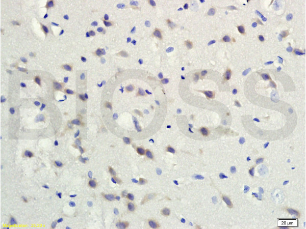 Formalin-fixed and paraffin embedded rat brain tissue labeled with Rabbit Anti-gremlin Polyclonal Antibody (bs-1475R) at 1:200 followed by conjugation to the secondary antibody and DAB staining.