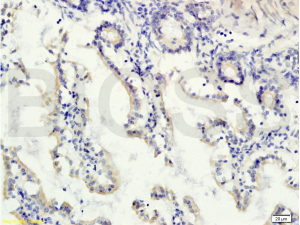 Formalin-fixed and paraffin embedded rat small intestine tissue labeled with Rabbit Anti-gremlin Polyclonal Antibody (bs-1475R) at 1:200 followed by conjugation to the secondary antibody and DAB staining.