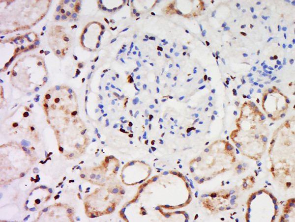 Paraformaldehyde-fixed, paraffin embedded human kidney; Antigen retrieval by boiling in sodium citrate buffer (pH6) for 15min; Block endogenous peroxidase by 3% hydrogen peroxide for 30 minutes; Blocking buffer (normal goat serum) at 37°C for 20min; Antibody incubation with CCDC30 Polyclonal Antibody, Unconjugated (bs-8097R) at 1:500 overnight at 4°C, followed by a conjugated secondary and DAB staining