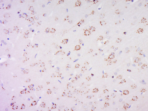 Paraformaldehyde-fixed, paraffin embedded rat brain; Antigen retrieval by boiling in sodium citrate buffer (pH6) for 15min; Block endogenous peroxidase by 3% hydrogen peroxide for 30 minutes; Blocking buffer (normal goat serum) at 37°C for 20min; Antibody incubation with PAS1C1 Polyclonal Antibody, Unconjugated (bs-9031R) at 1:500 overnight at 4°C, followed by a conjugated secondary and DAB staining