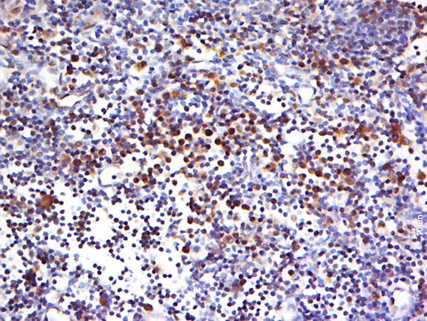 Paraformaldehyde-fixed, paraffin embedded rat thymus; Antigen retrieval by boiling in sodium citrate buffer (pH6) for 15min; Block endogenous peroxidase by 3% hydrogen peroxide for 30 minutes; Blocking buffer (normal goat serum) at 37°C for 20min; Antibody incubation with HECA Polyclonal Antibody, Unconjugated (bs-9702R) at 1:500 overnight at 4°C, followed by a conjugated secondary and DAB staining.