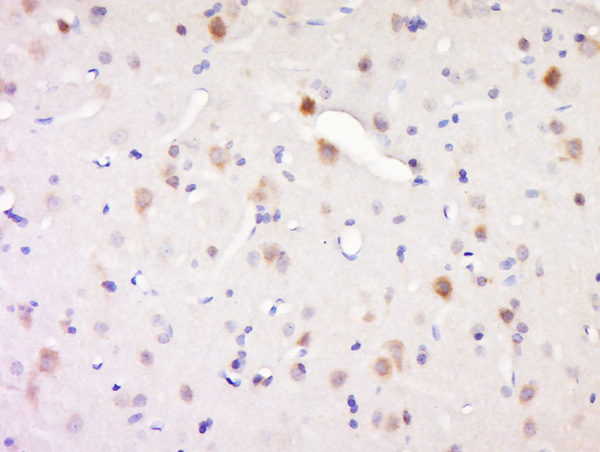 Paraformaldehyde-fixed, paraffin embedded rat brain; Antigen retrieval by boiling in sodium citrate buffer (pH6) for 15min; Block endogenous peroxidase by 3% hydrogen peroxide for 30 minutes; Blocking buffer (normal goat serum) at 37°C for 20min; Antibody incubation with Synaptojanin 1 Antibody, Unconjugated (bs-11376R) at 1:200 overnight at 4°C, followed by a conjugated secondary and DAB staining.