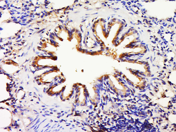 Paraformaldehyde-fixed, paraffin embedded rat lung; Antigen retrieval by boiling in sodium citrate buffer (pH6) for 15min; Block endogenous peroxidase by 3% hydrogen peroxide for 30 minutes; Blocking buffer (normal goat serum) at 37°C for 20min; Antibody incubation with FTSJ1 Polyclonal Antibody, Unconjugated (bs-12264R) at 1:500 overnight at 4°C, followed by a conjugated secondary and DAB staining.