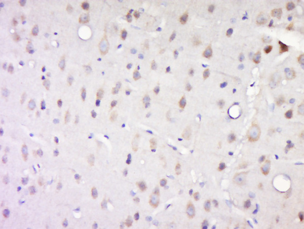 Paraformaldehyde-fixed, paraffin embedded rat brain; Antigen retrieval by boiling in sodium citrate buffer (pH6) for 15min; Block endogenous peroxidase by 3% hydrogen peroxide for 30 minutes; Blocking buffer (normal goat serum) at 37°C for 20min; Antibody incubation with Casein Kinase 1 alpha (Tyr294) Antibody, Unconjugated (bs-12428R) at 1:200 overnight at 4°C, followed by a conjugated secondary and DAB staining.