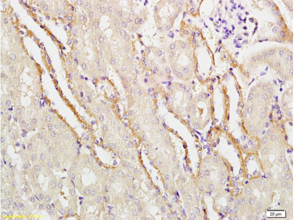Formalin-fixed and paraffin embedded mouse kidney labeled with Rabbit Anti-APG5L/ATG5 Polyclonal Antibody (bs-4005R) at 1:100 followed by conjugation to the secondary antibody and DAB staining.