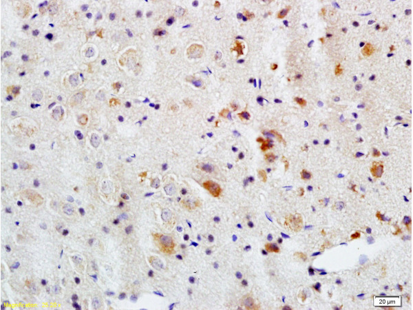 Formalin-fixed and paraffin embedded rat brain tissue labeled with Rabbit Anti-APG5L/ATG5 Polyclonal Antibody (bs-4005R ) at 1:200 followed by conjugation to the secondary antibody and DAB staining.