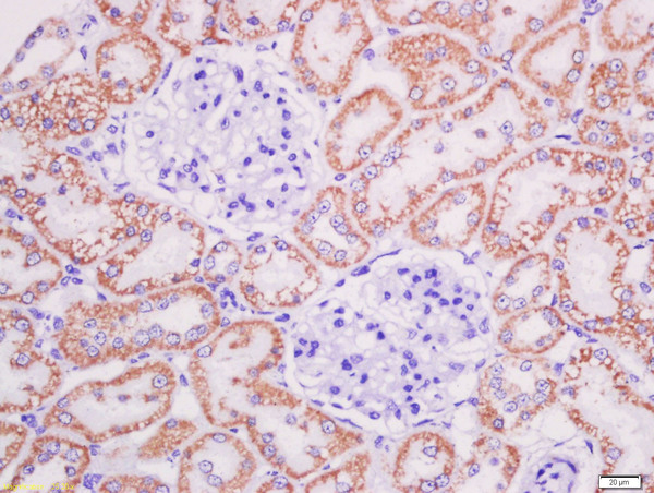 Paraformaldehyde-fixed, paraffin embedded rat kidney; Antigen retrieval by boiling in sodium citrate buffer (pH6) for 15min; Block endogenous peroxidase by 3% hydrogen peroxide for 30 minutes; Blocking buffer (normal goat serum) at 37°C for 20min; Antibody incubation with AGEs Polyclonal Antibody, Unconjugated (bs-1158R) at 1:200 overnight at 4°C, followed by a conjugated secondary and DAB staining.