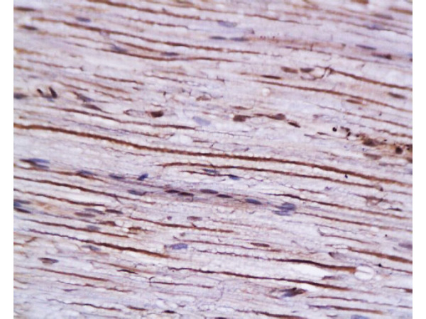 Formalin-fixed and paraffin embedded: rat sciatic nerve labeled with Anti-AGER/RAGE Polyclonal Antibody, Unconjugated (bs-0177R) at 1:200 followed by conjugation to the secondary antibody and DAB staining Formalin-fixed and paraffin embedded: rat sciatic nerve labeled with Anti-AGER/RAGE Polyclonal Antibody, Unconjugated (bs-0177R) at 1:200 followed by conjugation to the secondary antibody and DAB staining