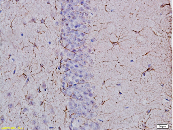 Formalin-fixed and paraffin embedded: rat brain tissue Anti-GFAP Polyclonal Antibody, Unconjugated (bs-0199R) at 1:400, followed by conjugation to the secondary antibody and DAB staining