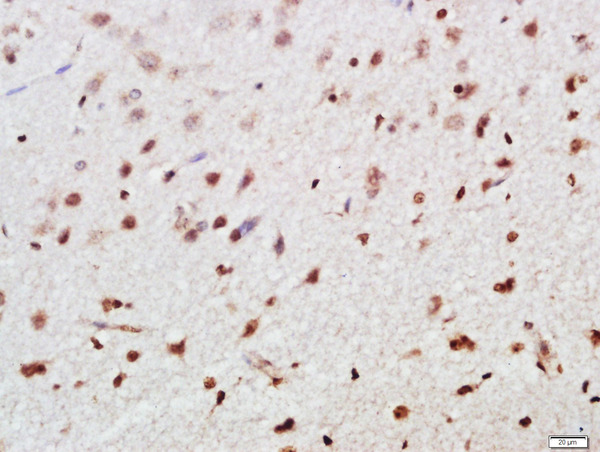 Paraformaldehyde-fixed, paraffin embedded rat brain tissue; Antigen retrieval by boiling in sodium citrate buffer(pH6) for 15min; Block endogenous peroxidase by 3% hydrogen peroxide for 30 minutes; Blocking buffer (normal goat serum) at 37°C for 20min; Antibody incubation with FoxP3 Polyclonal Antibody, Unconjugated (bs-10211R) at 1:500 overnight at 4°C, followed by a conjugated secondary and DAB staining
