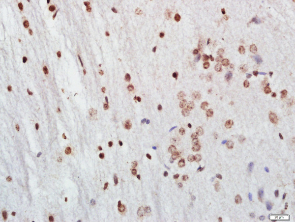 Paraformaldehyde-fixed, paraffin embedded rat brain tissue; Antigen retrieval by boiling in sodium citrate buffer(pH6) for 15min; Block endogenous peroxidase by 3% hydrogen peroxide for 30 minutes; Blocking buffer (normal goat serum) at 37°C for 20min; Antibody incubation with FoxP3 Polyclonal Antibody, Unconjugated (bs-10211R) at 1:500 overnight at 4°C, followed by a conjugated secondary and DAB staining