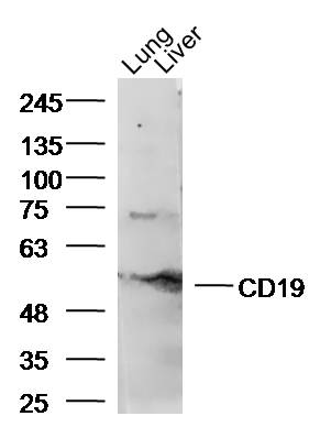 Mouse lung and liver lysates probed with CD19 Polyclonal Antibody, unconjugated (bs-4755R) at 1:300 overnight at 4\u00b0C followed by a conjugated secondary antibody at 1:10000 for 90 minutes at 37\u00b0C.\\n