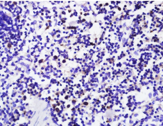 Paraformaldehyde-fixed, paraffin embedded mouse lymph node; Antigen retrieval by boiling in sodium citrate buffer (pH6) for 15min; Block endogenous peroxidase by 3% hydrogen peroxide for 30 minutes; Blocking buffer (normal goat serum) at 37°C for 20min; Antibody incubation with FoxP3 Polyclonal Antibody, Unconjugated (bs-10211R) at 1:200 overnight at 4°C, followed by a conjugated secondary and DAB staining.