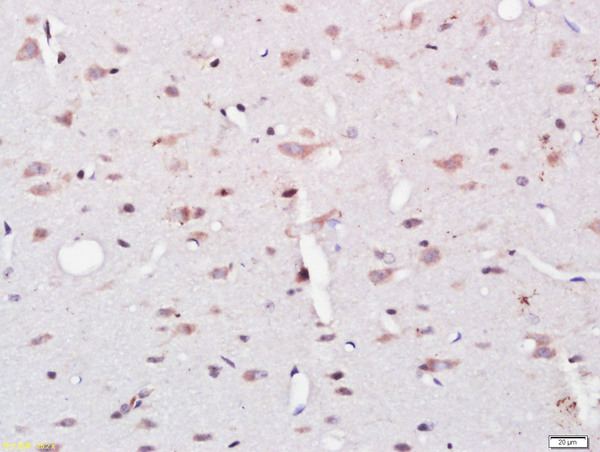 Paraformaldehyde-fixed, paraffin embedded rat brain; Antigen retrieval by boiling in sodium citrate buffer (pH6) for 15min; Block endogenous peroxidase by 3% hydrogen peroxide for 30 minutes; Blocking buffer (normal goat serum) at 37°C for 20min; Antibody incubation with UBE2W Polyclonal Antibody, Unconjugated (bs-8385R ) at 1:200 overnight at 4°C, followed by a conjugated secondary and DAB staining.