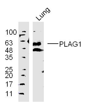 Lane 1: mouse lung lysates probed with \\tPLAG1 Polyclonal Antibody, Unconjugated (bs-10092R) at 1:300 overnight at 4˚C. Followed by a conjugated secondary antibody at 1:10000 for 90 min at 37˚C.
