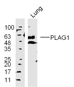 Lane 1: mouse lung lysates probed with \tPLAG1 Polyclonal Antibody, Unconjugated (bs-10092R) at 1:300 overnight at 4˚C. Followed by a conjugated secondary antibody at 1:10000 for 90 min at 37˚C.
