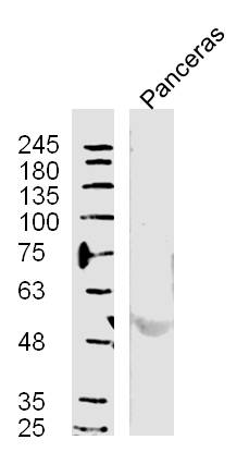 Mouse Pancreas lysates probed with Polyclonal Antibody, unconjugated (bs-11553R) at 1:300 overnight at 4°C followed by a conjugated secondary antibody at 1:10000 for 60 minutes at 37°C.