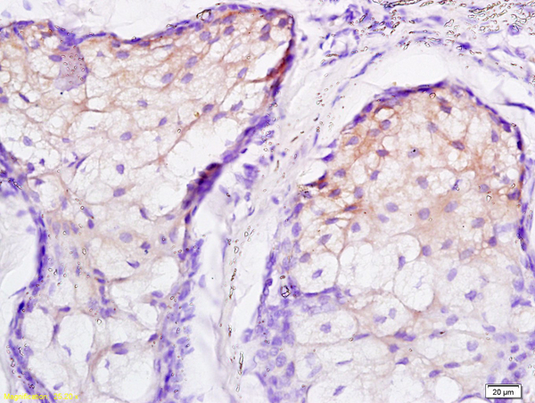 Formalin-fixed and paraffin embedded human scalp labeled with Rabbit Anti JNK2 Polyclonal Antibody, Unconjugated (bs-2900R) at 1:200 followed by conjugation to the secondary antibody and DAB staining