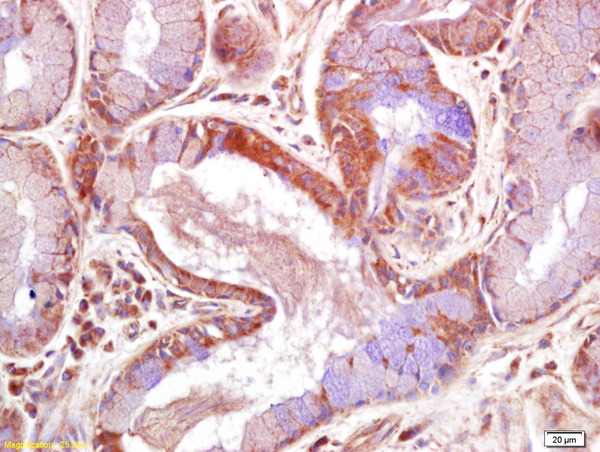 Formalin-fixed and paraffin embedded human skin labeled with Rabbit Anti JNK2 Polyclonal Antibody, Unconjugated (bs-2900R) at 1:200 followed by conjugation to the secondary antibody and DAB staining