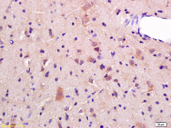 Formalin-fixed and paraffin embedded rat brain labeled with Rabbit Anti JNK2 Polyclonal Antibody, Unconjugated (bs-2900R) at 1:200 followed by conjugation to the secondary antibody and DAB staining