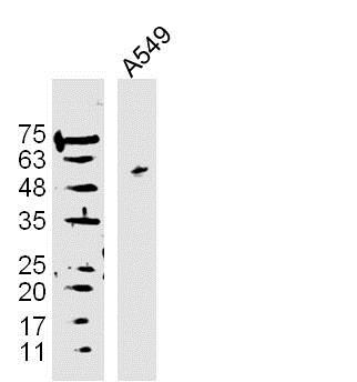 A549 cells lysates probed with DAPK3 Polyclonal Antibody, Unconjugated (bs-1692R) at 1:300 overnight at 4˚C. Followed by a conjugated secondary antibody at 1:10000 for 90 min at 37˚C.