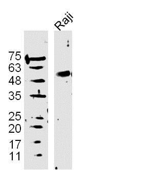 Raji cells lysates probed with DAPK3 Polyclonal Antibody, Unconjugated (bs-1692R) at 1:300 overnight at 4˚C. Followed by a conjugated secondary antibody at 1:10000 for 90 min at 37˚C.